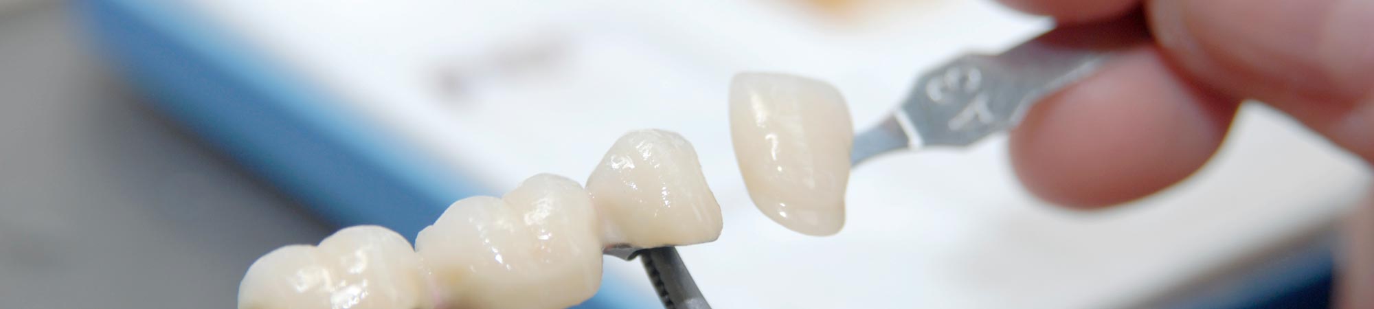 Smile 3D